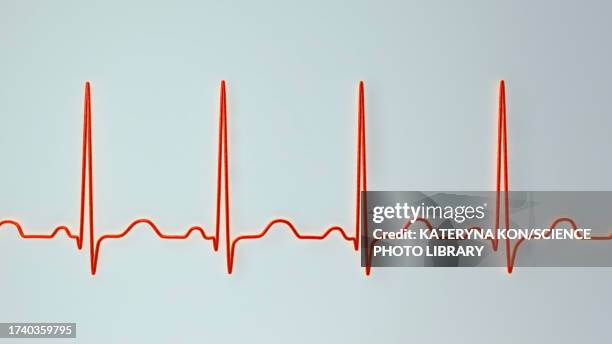 illustrations, cliparts, dessins animés et icônes de sinus tachycardia heartbeat rhythm, illustration - rythme cardiaque