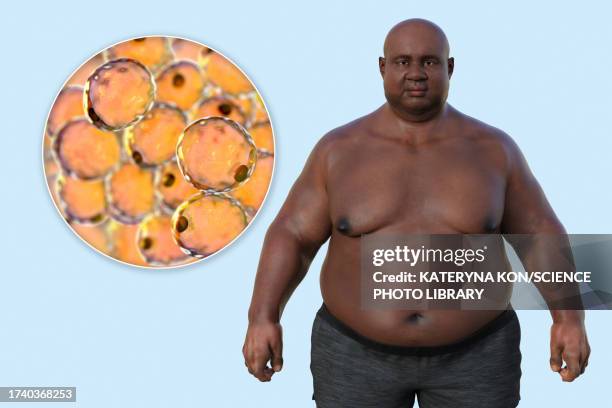 ilustraciones, imágenes clip art, dibujos animados e iconos de stock de overweight man with adipocytes, illustration - tejido adiposo