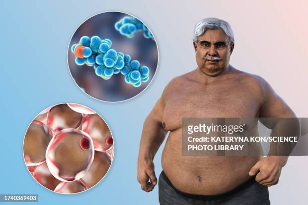 overweight man with adipocytes and cholesterol, illustration - fat stock illustrations