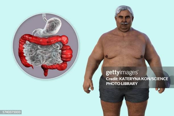 irritable bowel syndrome, illustration - bloating stock illustrations