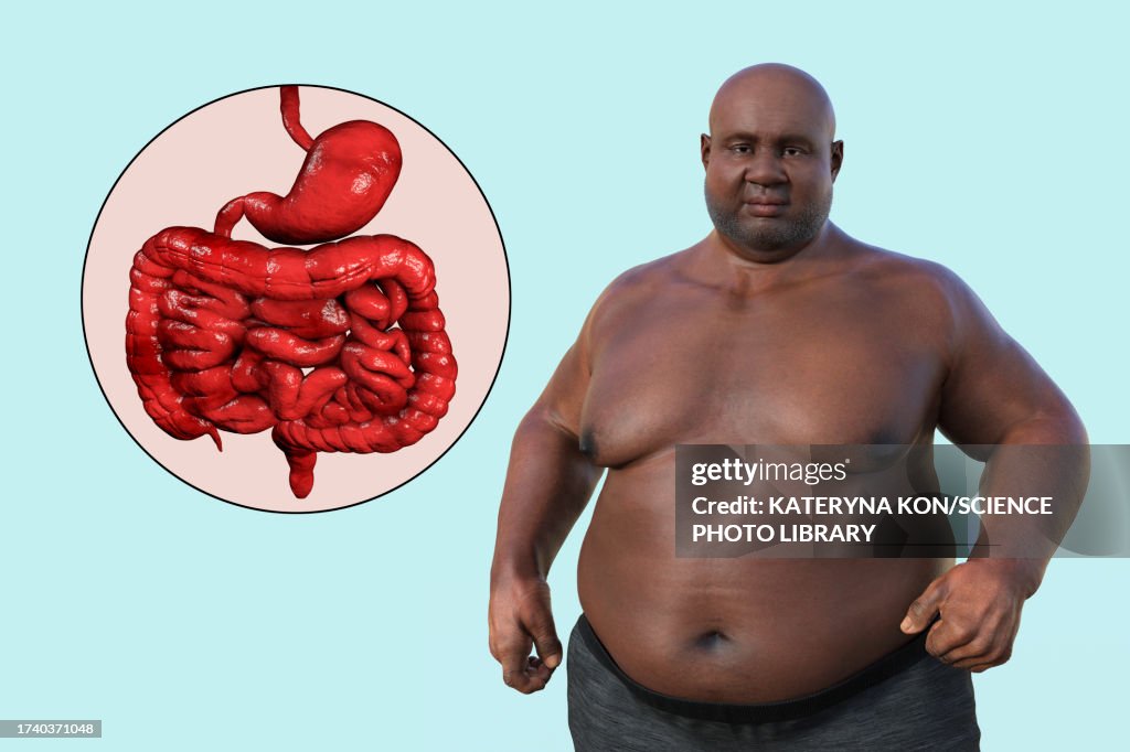 Obese Mans Digestive System Illustration High-Res Vector Graphic ...