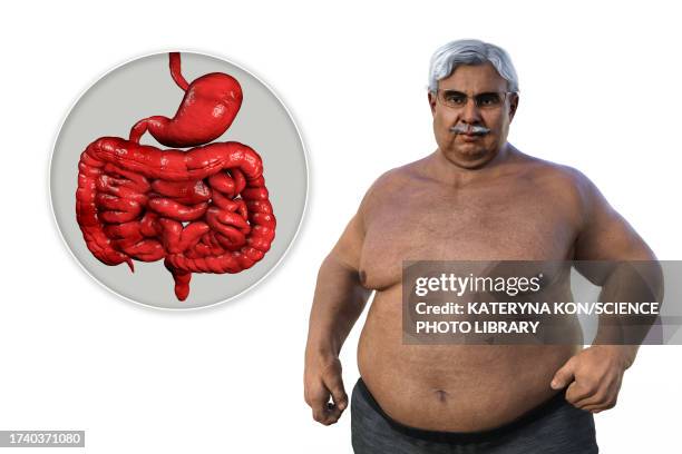 obese man's digestive system, illustration - human build stock illustrations