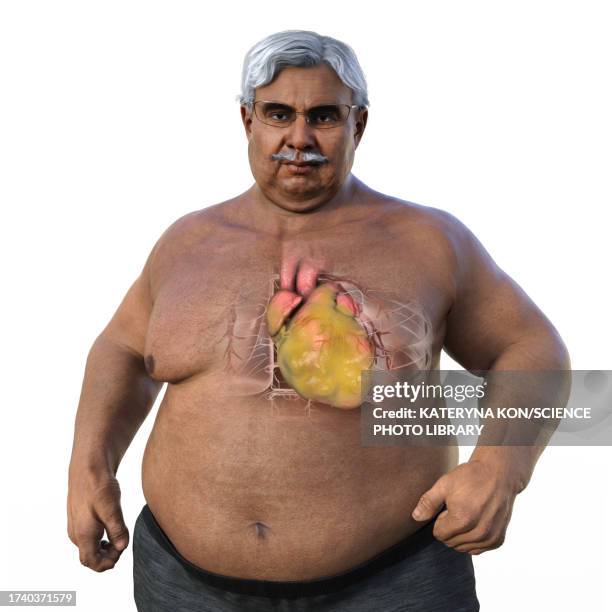 overweight man with enlarged heart, illustration - fat asian man stock illustrations