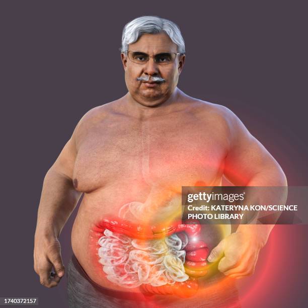 irritable bowel syndrome, illustration - fat asian man stock illustrations