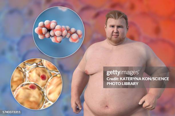 ilustraciones, imágenes clip art, dibujos animados e iconos de stock de overweight man with adipocytes and cholesterol, illustration - tejido adiposo
