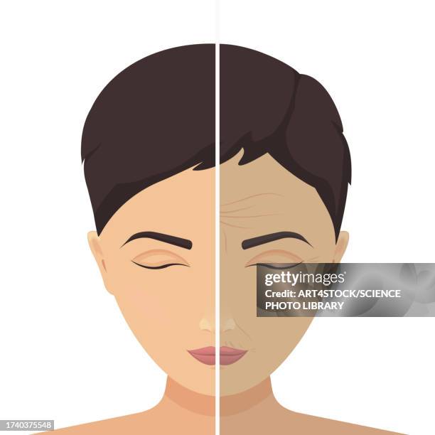 beauty treatment before and after, illustration - botox injection stock illustrations