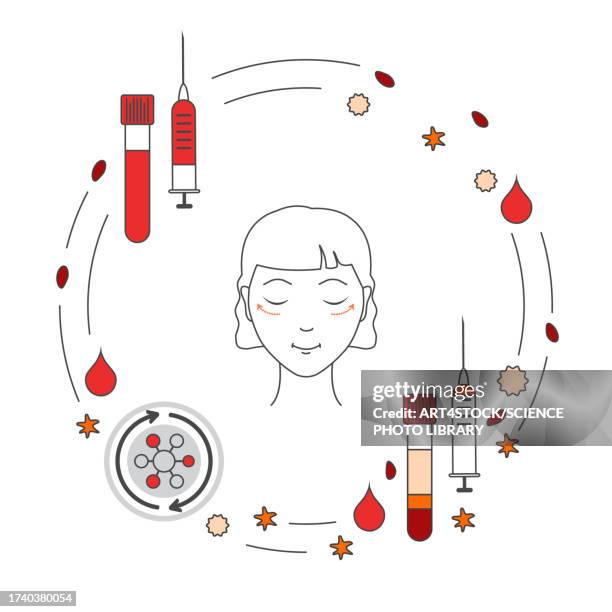 platelet-rich plasma in cosmetology, conceptual illustration - surgical equipment stock illustrations