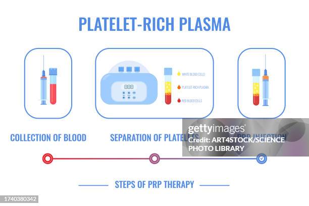 platelet rich plasma procedure, conceptual illustration - knee injection stock illustrations