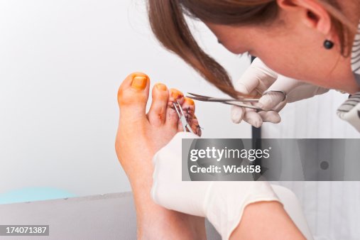 Nurse Pulling Surgical Threads Nurse Pulling Surgical Threads