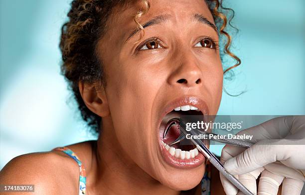 woman having tooth removed - tandfyllning bildbanksfoton och bilder