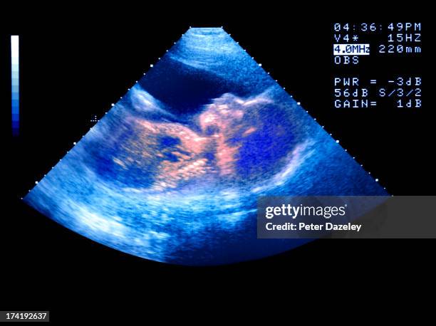 ivf baby scan - ecografia foto e immagini stock