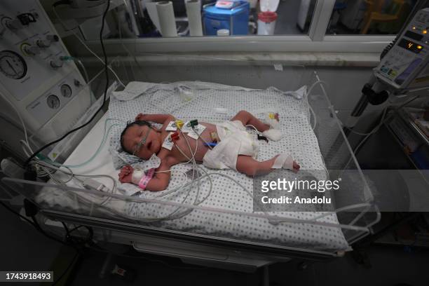 Newborn is seen at Nasser Hospital, born after his mother was killed in an Israeli airstrike in Khan Yunis, Gaza on October 24, 2023. The Palestinian...