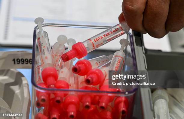 October 2023, Berlin: In the Checkpoint BLN in Hermannstraße there are serum tubes for HIV tests. The Checkpoint BLN is a contact point for any...