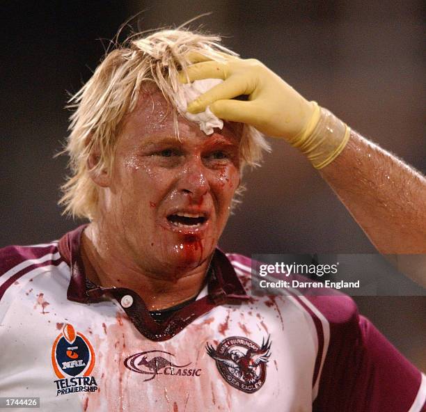 Nathan Long of Manly is taken to the blood bin during the NRL practice match played between the Parramatta Eels and the Manly Sea Eagles at Carrara...