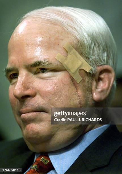 Traces of recent skin cancer surgery remains on the face of US Senator John McCain 13 September, 2000. McCain returned to work as chairman of the US...
