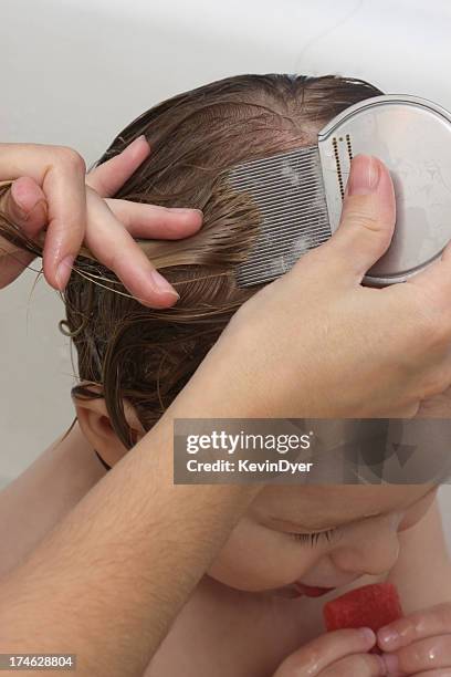 piolho da cabeça tratamento - piolho humano imagens e fotografias de stock