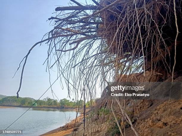 Tooth Roots Photos and Premium High Res Pictures - Getty Images