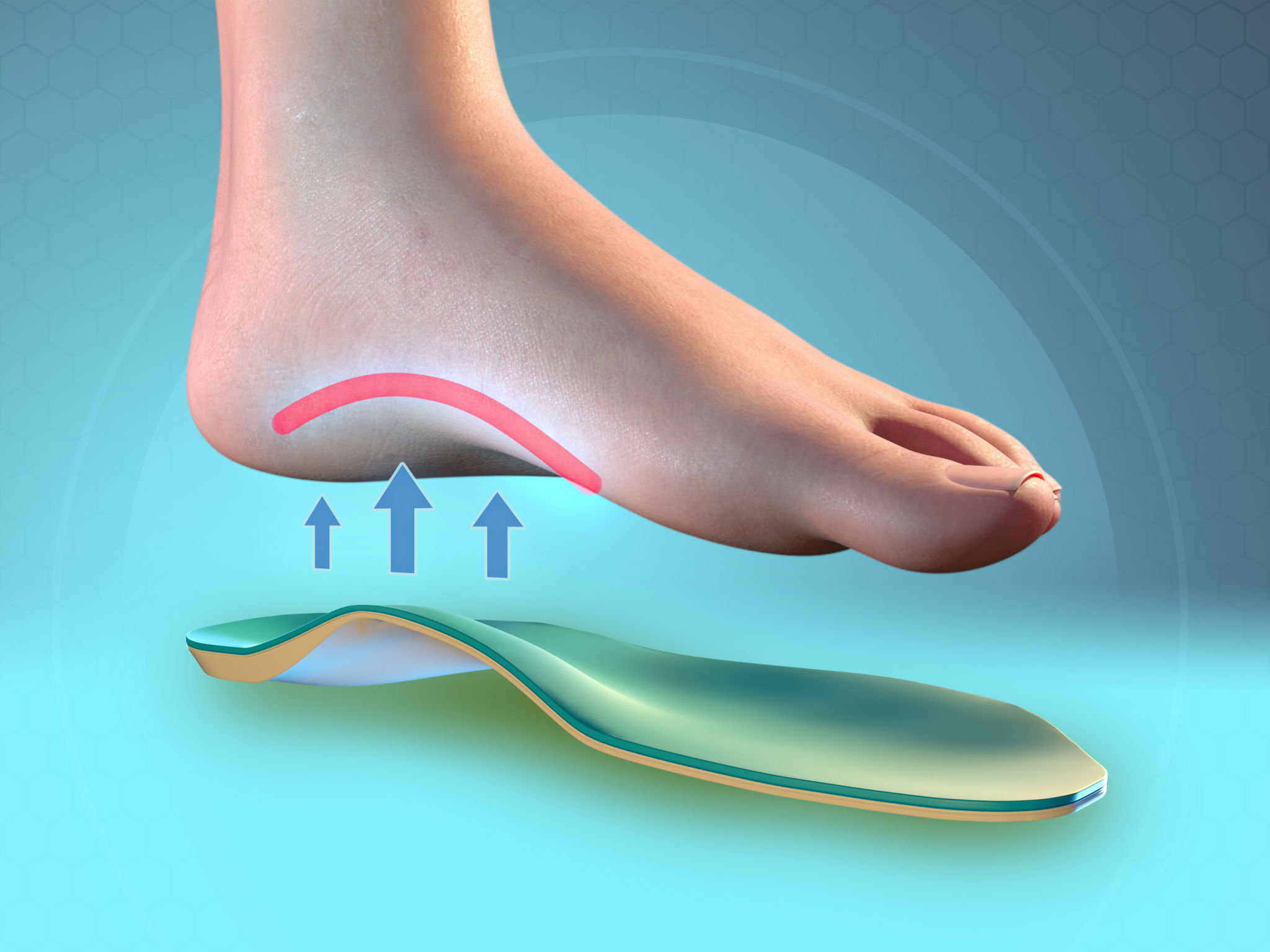 Foot arch support Foot arch support