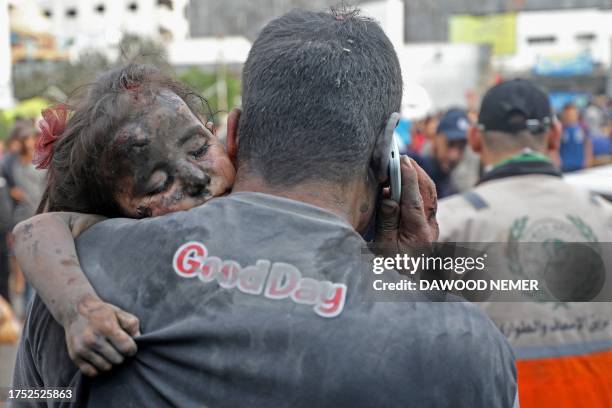 Graphic content / TOPSHOT - A Palestinian man covered with dust carries an injured baby girl into the Al-Shifa hopsital in Gaza City following...