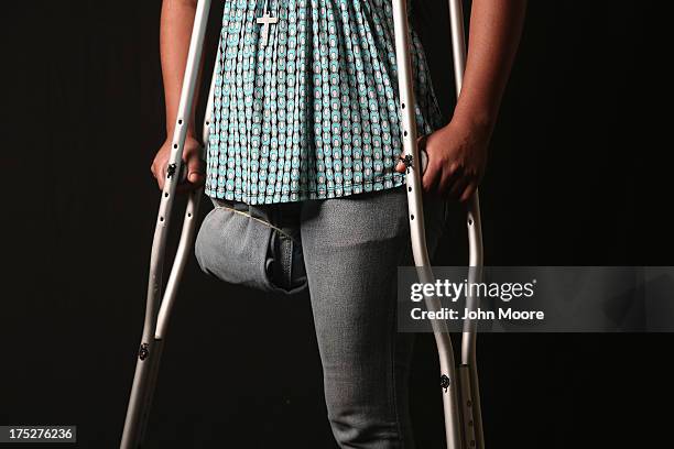 Undocumented Guatemalan immigrant Elvira Lopez stands on crutches at the Jesus el Buen Pastor shelter on July 31, 2013 in Tapachula, Mexico. She has...