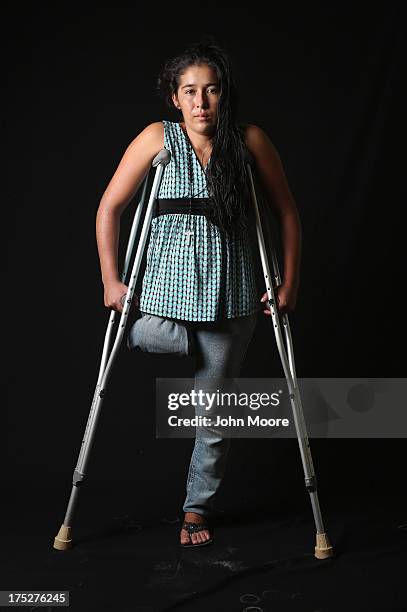 Undocumented Guatemalan immigrant Elvira Lopez stands on crutches at the Jesus el Buen Pastor shelter on July 31, 2013 in Tapachula, Mexico. She has...