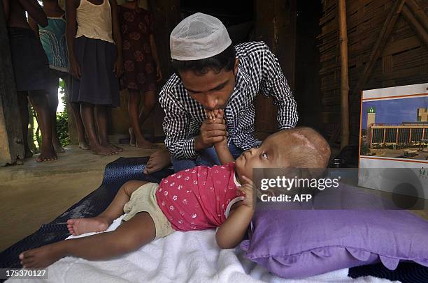 Baby Roona Baby Roona India _ Baby Roona Cause Of Death – MIQG