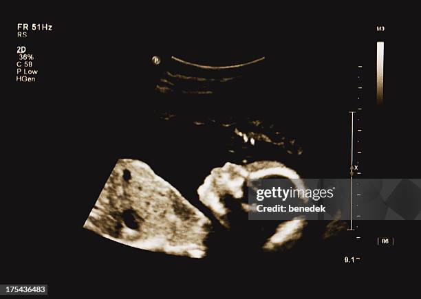 baby ultrasound - uterus stock pictures, royalty-free photos & images