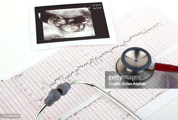 medizinischen tests und ultraschall-untersuchung der alter fötus - fetus stock-fotos und bilder