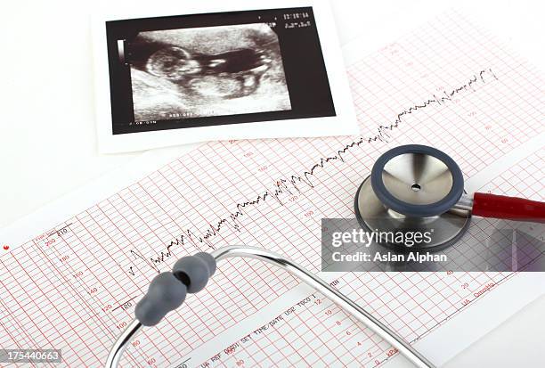 medical tests and ultrasound of the fetus - foetus stock pictures, royalty-free photos & images