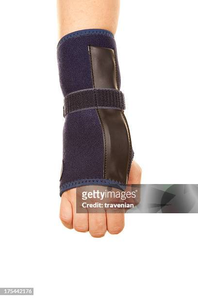fracture of arm - wrapping arm stock pictures, royalty-free photos & images