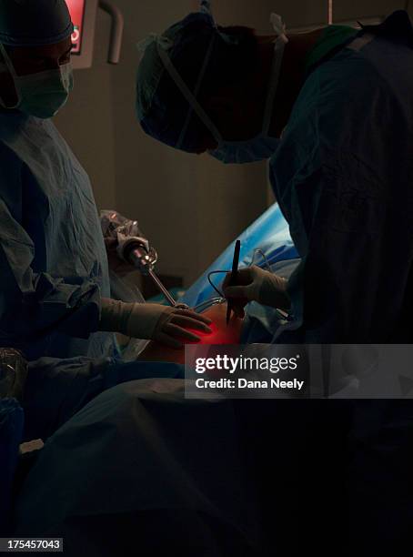 Robotic Surgery Incision Example Robotic Surgery Photos and Premium High Res Pictures - Getty Images