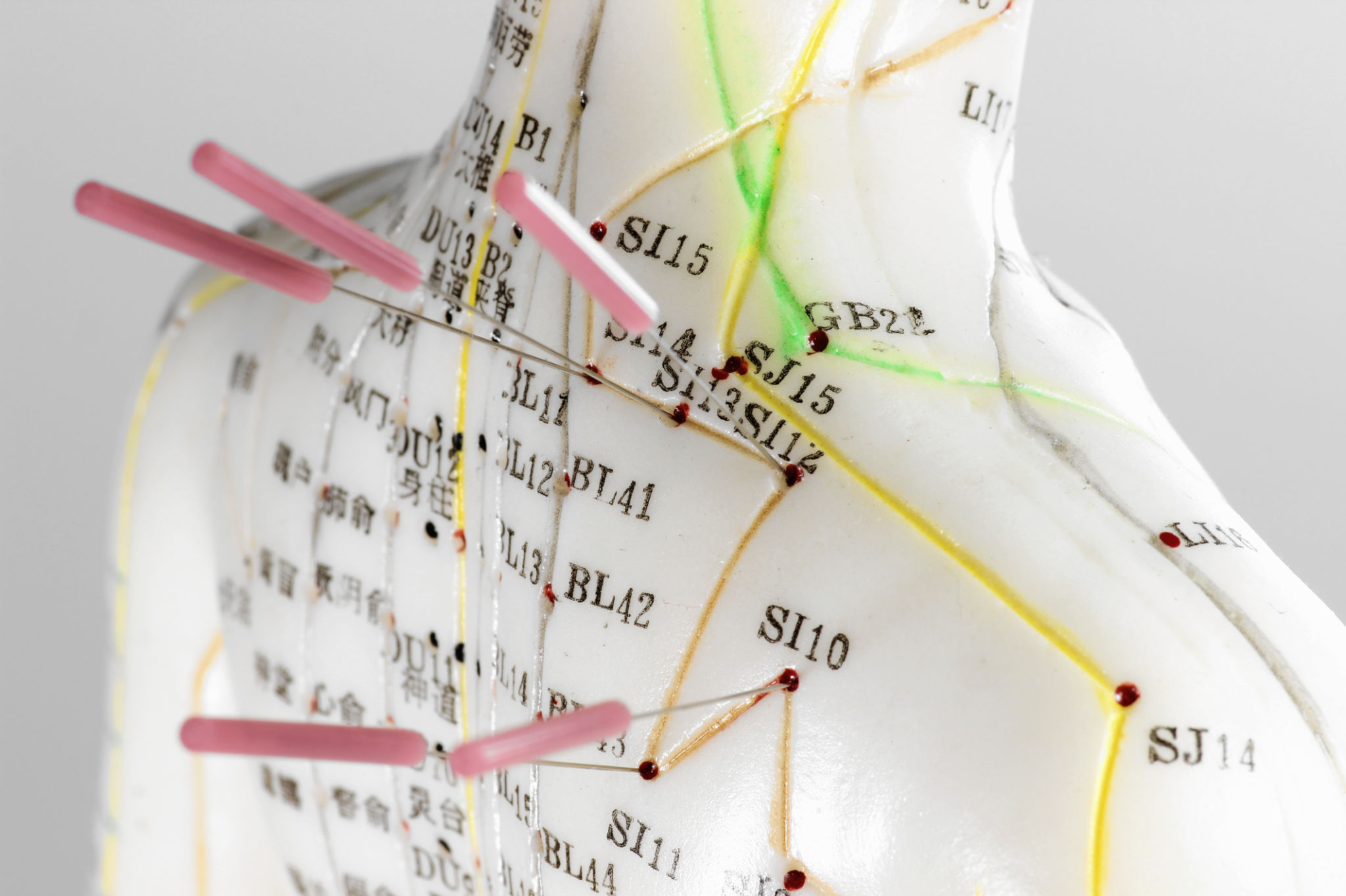 acupuncture practice