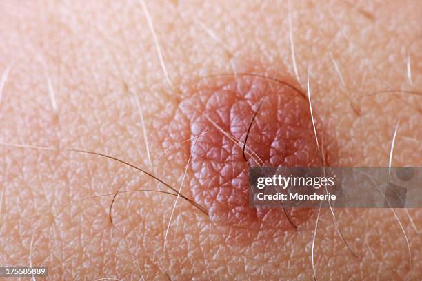 extreme close up of a skin mole - dotted human body part stock pictures, royalty-free photos & images