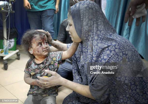 An injured child is brought to the Al Aqsa Hospital after the Israeli attack on Maghazi Refugee Camp in Deir al Balah, Gaza on November 03, 2023.