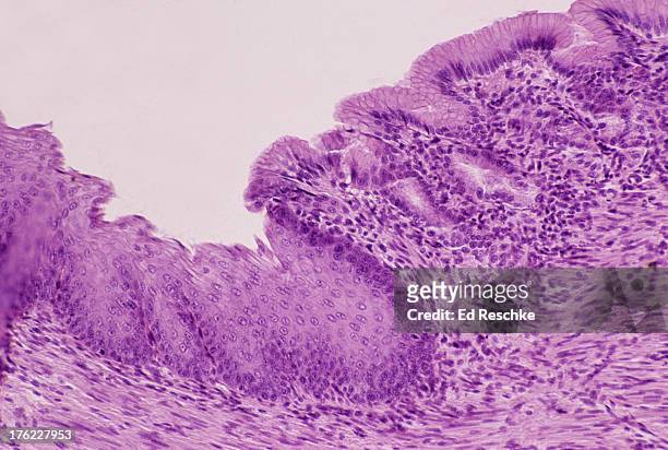 esophagus-stomach junction, histology, 50x - oesophagus stock pictures, royalty-free photos & images