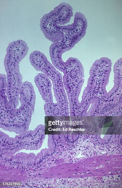 gallbladder, human, magnification 100x - simple columnar epithelial cell ストックフォトと画像