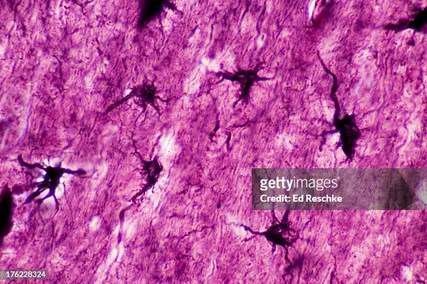 astrocytes--neuroglia or glial cells, human, 250x - astrocyte stockfoto's en -beelden