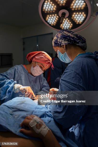 latina surgeon and her surgeon perform an operation in the operating room - blue surgical mask stock pictures, royalty-free photos & images