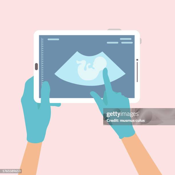 bildbanksillustrationer, clip art samt tecknat material och ikoner med doctor assessing baby's condition on digital tablet with ultrasound image in operating room - obstetrician