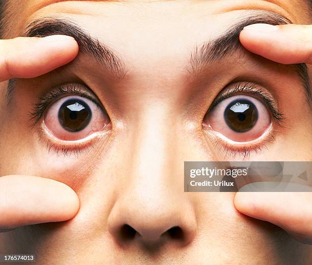 in need of some sleep.... - tired eyes stock pictures, royalty-free photos & images
