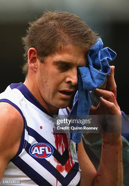 Aaron Sandilands of the Dockers comes off the ground with a cut to his head during the round 21 AFL match between the Melbourne Demons and the...