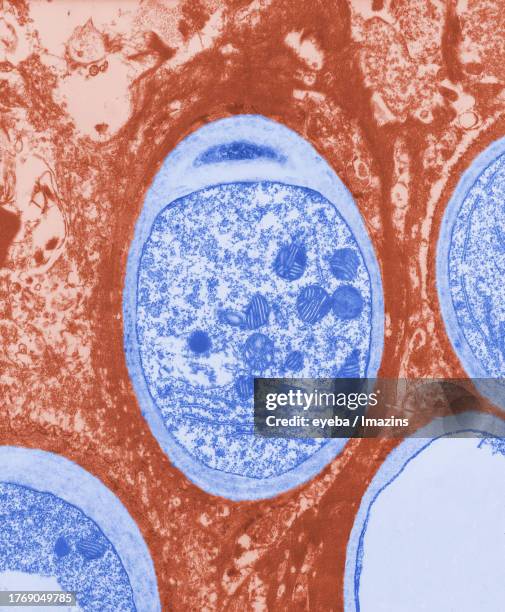 a transmission electron microscope image of an infected aspergillus heart - electron micrograph stock pictures, royalty-free photos & images