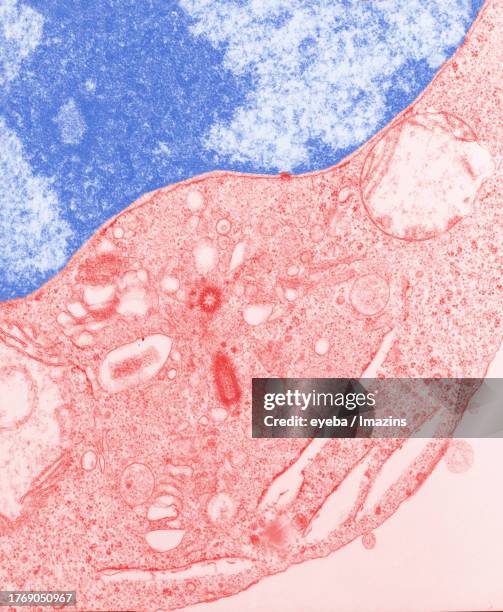 Chromatin Rbc 481 Chromatin Stock Photos, High-Res Pictures, and Images - Getty Images