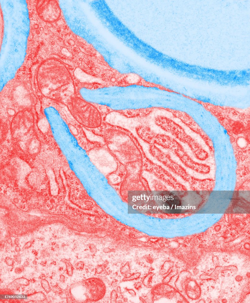 Transmission Electron Microscope Photo Of Infected Yeast Bacteria In transmission-electron-microscope-photo-of-infected-yeast-bacteria-in
