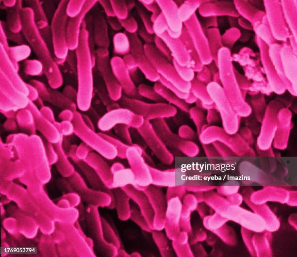 Tuberculosis Microscope Stock-Fotos und Bilder - Getty Images