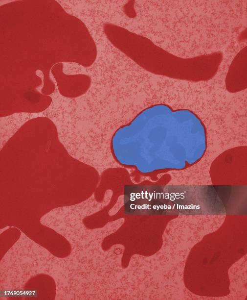 Imtamure Rbc Immature Red Blood Cell Photos and Premium High Res Pictures - Getty Images