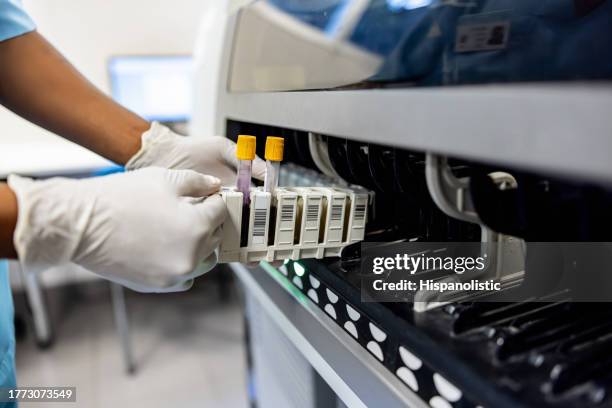 primer plano de un técnico que analiza muestras de sangre en el laboratorio - análisis-de-sangre-prueba-médica fotografías e imágenes de stock