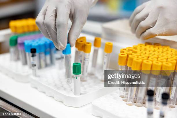 primo piano di un operatore sanitario che maneggia campioni di sangue in laboratorio - provetta foto e immagini stock