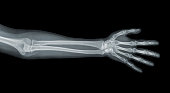 Hand x-ray view