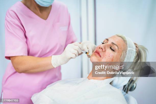frau, die sich einer kosmetischen behandlung mit blutplasma unterzieht - facelift stock-fotos und bilder